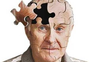 آلزایمر؛ دزدی خاموش حافظه از خانه تا جامعه