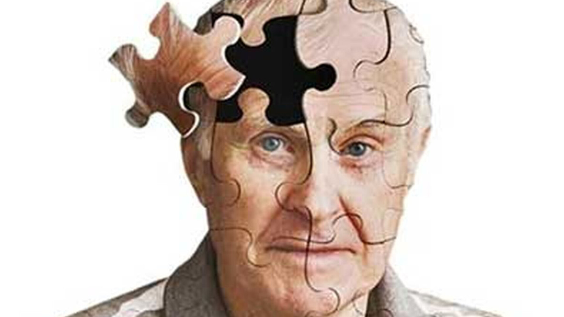 آلزایمر؛ دزدی خاموش حافظه از خانه تا جامعه